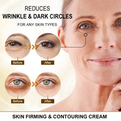 Peptide Eye Cream – Anti-Dark Circle & Firming Care