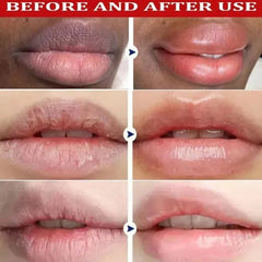 Lip Brightening Balm Serum – Nourishing Lip Care