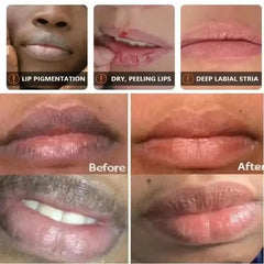 Lip Brightening Balm Serum – Nourishing Lip Care