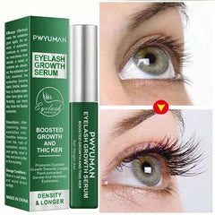 Natural Eyelash Growth Serum – Fuller & Longer Looking Lashes